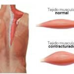 Técnicas de Masaje para Aliviar la Sobrecarga Muscular en la Espalda